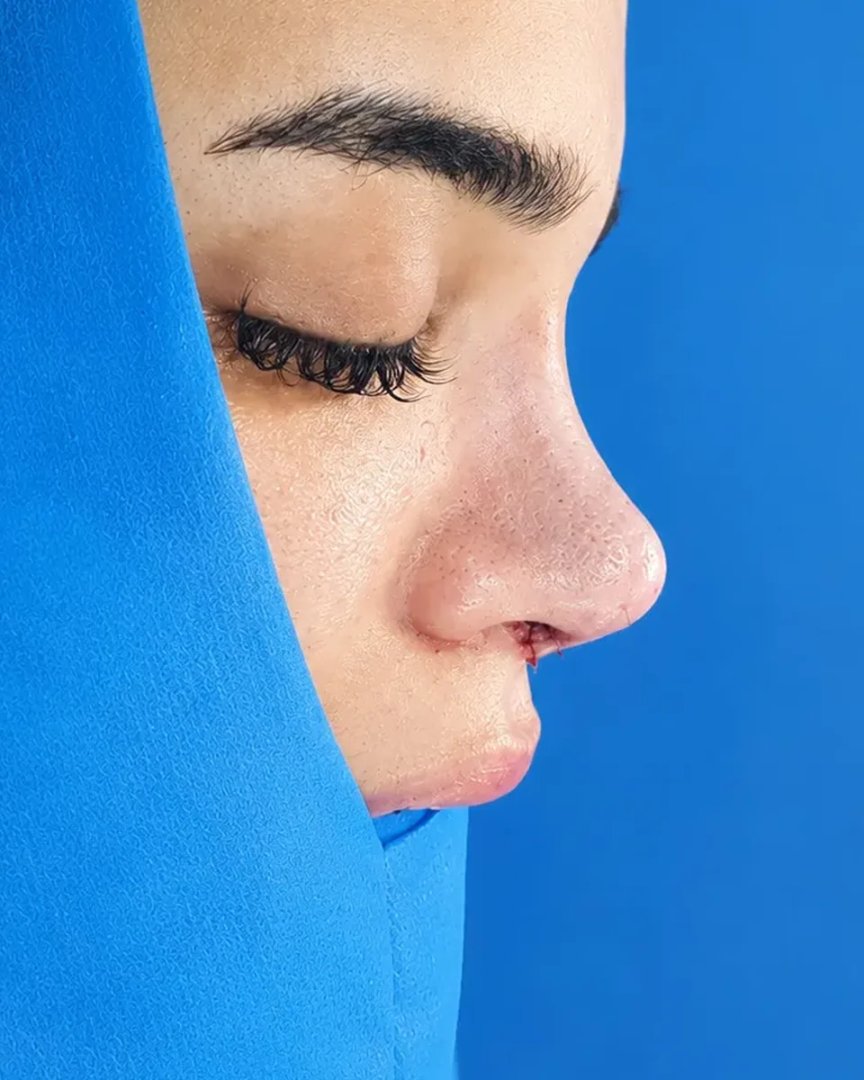 بعد